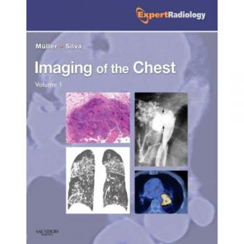 Imaging of the Chest, 2-Volume Set: Expert Radiology Series, 1e