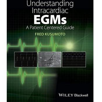 Understanding Intracardiac Electrograms: A Patient-Centered Guide (Paperback)