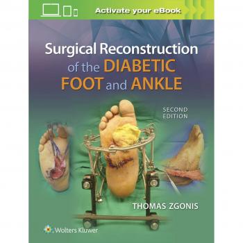 Diabetic Foot and Ankle Surgical Reconstruction Guide