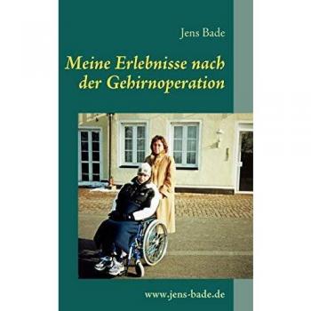 Experiencias Personales Tras la Cirugía Cerebral de Jens Bade