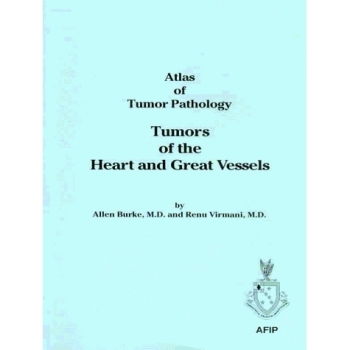 Atlas of Tumor Pathology: Tumors of the Heart and Great Vessels Vol 16