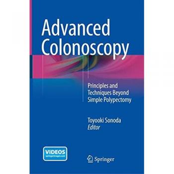 Advanced Colonoscopy: Principles and Techniques Beyond Simple Polypectomy