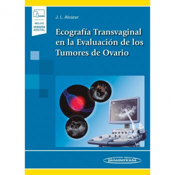 Ecografía Transvaginal en la Evaluación de los Tumores de Ovario