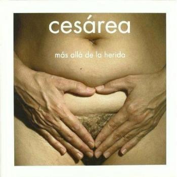 Cesarea - mas alla de la herida