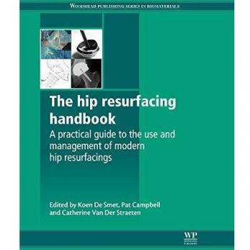 The Hip Resurfacing Handbook: A Practical Guide to the Use and Management of Modern Hip Resurfacings: 47