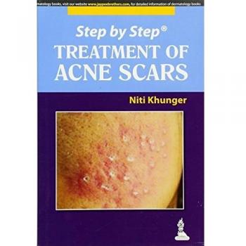 Step by Step: Treatment of Acne Scars