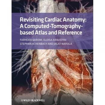 Cardiac Anatomy Atlas: CT-Based Reference Guide