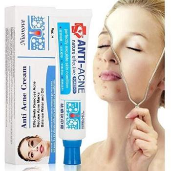 Crema Antiacne, Acné Crema, Acne Tratamiento, Reducir los Puntos negros, Equilibrar el Agua y el Aceite, la Crema Contra el Acné Espinilla Regenera la piel, 30 g
