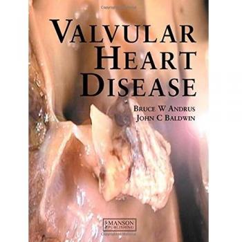 Valvular Heart Disease