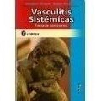 VASCULITIS SISTEMICAS