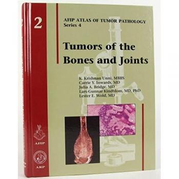 Tumors of the Bones and Joints: 2