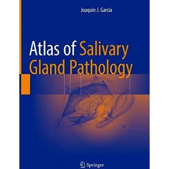 Atlas of Salivary Gland Pathology
