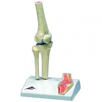 3B Scientific A85/1 Modelo Anatómico Humano - Mini Articulación de la Rodilla Con Corte Transversal + Software de Anatomía - 3B Smart Anatomy