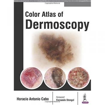 Color Atlas of Dermoscopy