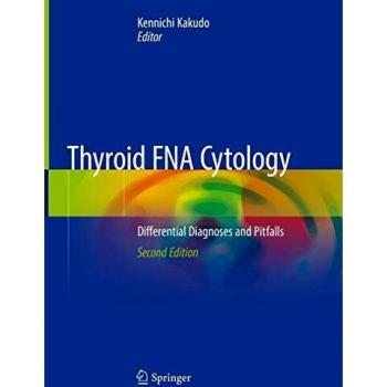 Thyroid FNA Cytology: Differential Diagnoses and Pitfalls