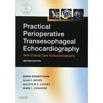 Practical Perioperative Transesophageal Echocardiography: Text with DVD-ROM, 2e