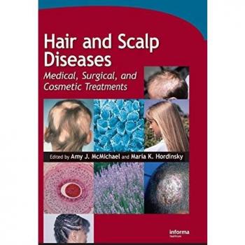 Hair and Scalp Diseases: Medical, Surgical, and Cosmetic Treatments
