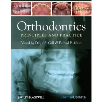 Orthodontics: Principles and Practice