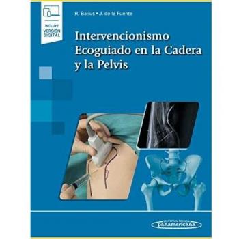 Intervencionismo Ecoguiado En La cadera y La Pelvis