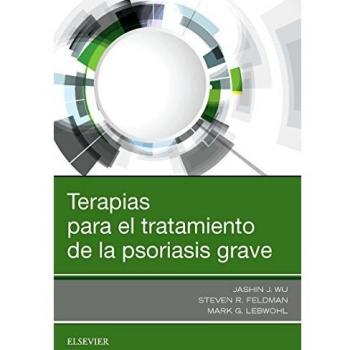 Terapias para el tratamiento de la psoriasis grave