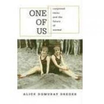 One of Us: Conjoined Twins and the Future of Normal