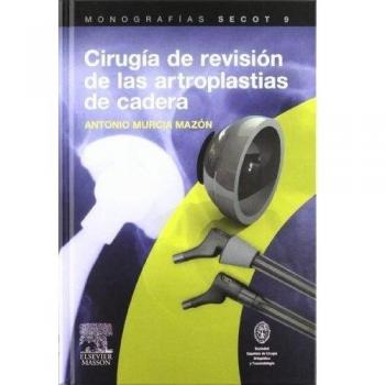 Cirugía de revisión de las artroplastias de cadera