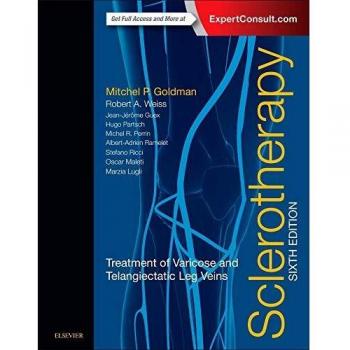 Sclerotherapy: Treatment of Varicose and Telangiectatic Leg Veins, 6e