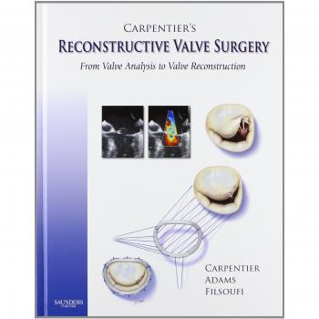 Carpentier's Reconstructive Valve Surgery by David H. Adams - Comprehensive Guide to Cardiac Surgery Techniques