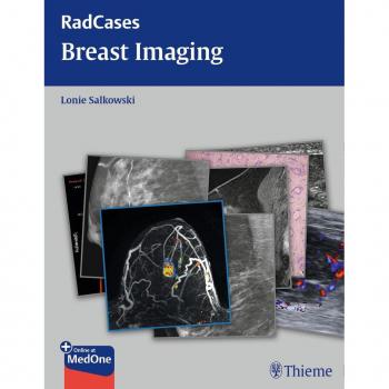 Comprehensive Breast Imaging Solutions