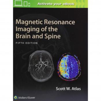 Magnetic Resonance Imaging of the Brain and Spine