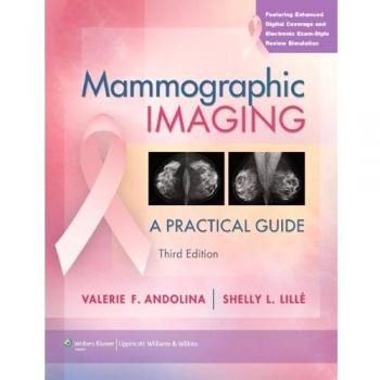 Mammographic Imaging: A Practical Guide