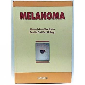 Melanoma