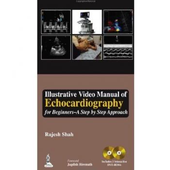 Illustrative Video Manual of Echocardiography for Beginners - A Step by Step Approach