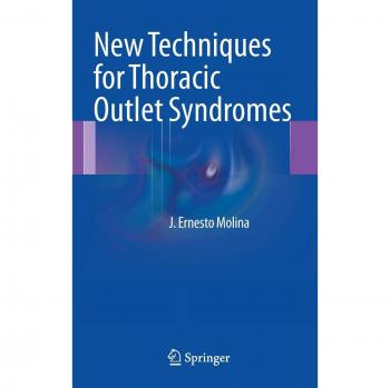 Innovative Approaches to Thoracic Outlet Syndrome Management