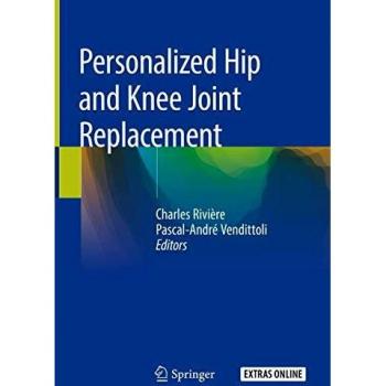 Personalized Hip and Knee Joint Replacement