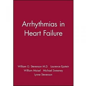 Arrhythmias in Heart Failure