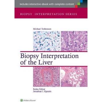 Biopsy Interpretation of the Liver