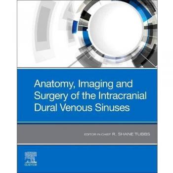 Anatomy, Imaging and Surgery of the Intracranial Dural Venous Sinuses, 1e
