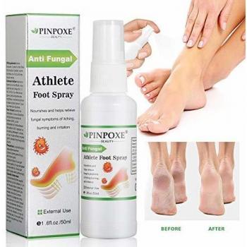Athletes Foot Spray, Spray para pies, Pies Fungus Treatment, Pies Treatment, Ayuda a tratar y restaurar la apariencia del pie infectado con hongos