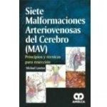 SIETE MALFORMACIONES ARTERIOVENOSAS DEL CEREBRO PRINCIPIOS