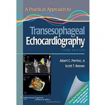 Practical Guide to Transesophageal Echocardiography