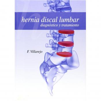 Hernia discal lumbar: diagnóstico y tratamiento