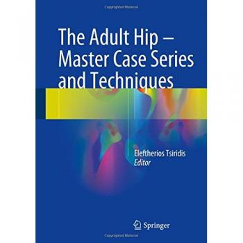 Adult Hip Surgery: Master Techniques and Case Studies