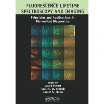 Fluorescence Lifetime Spectroscopy and Imaging: Principles and Applications in Biomedical Diagnostics