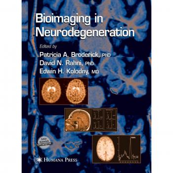 Bioimaging Techniques for Neurodegenerative Disorders (Contemporary Neuroscience Series)