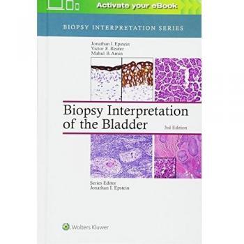 Biopsy Interpretation of the Bladder