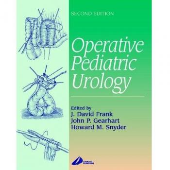Operative Pediatric Urology