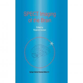 Spect Imaging of the Brain: 29
