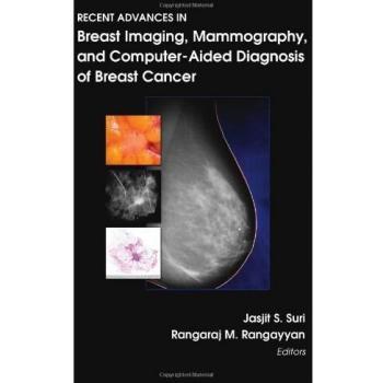 Recent Advances in Breast Imaging, Mammography, and Computer-aided Diagnosis of Breast Cancer
