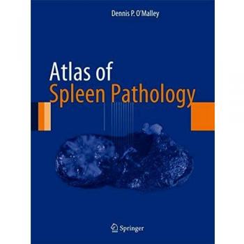 Comprehensive Atlas of Spleen Pathology and Anatomic Insights